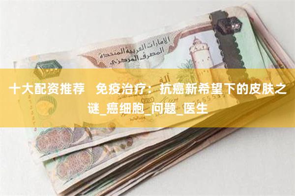 十大配资推荐   免疫治疗：抗癌新希望下的皮肤之谜_癌细胞_问题_医生